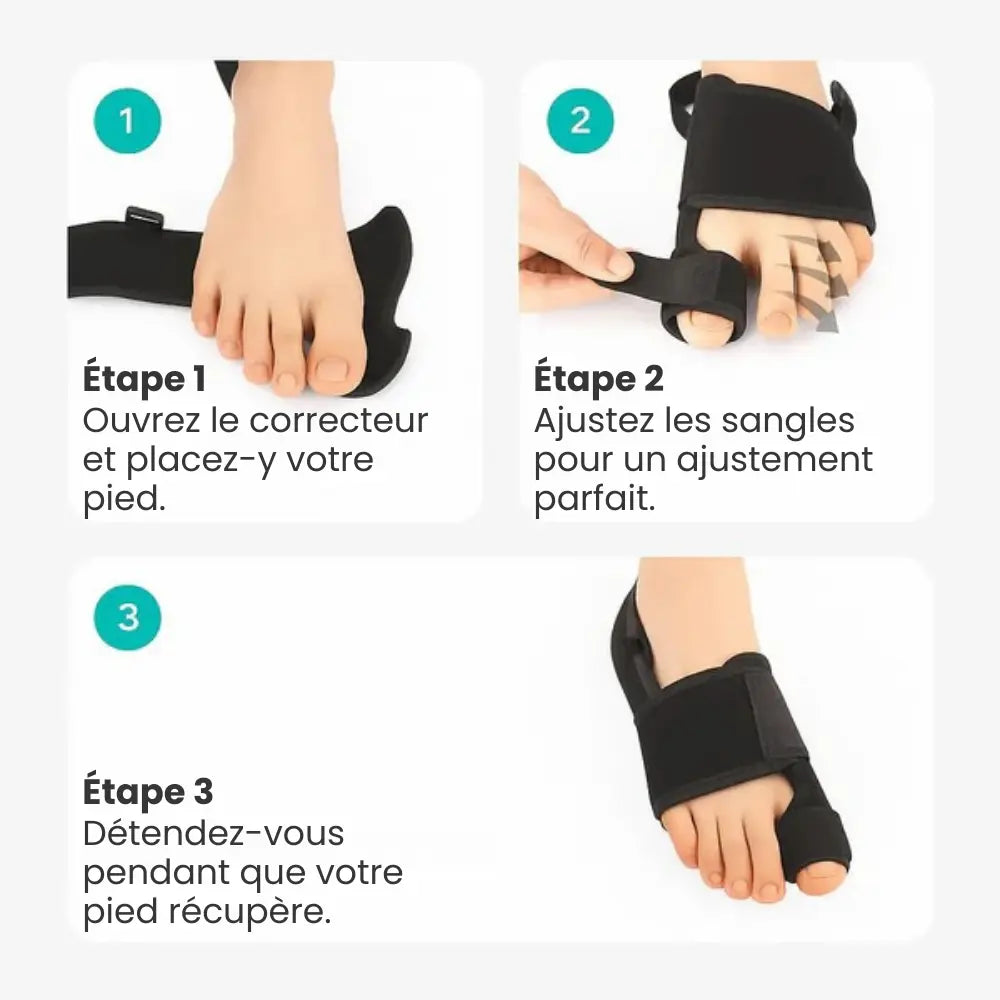 Correcteur Hallux Valgus – Soulagement Doux & Alignement Naturel